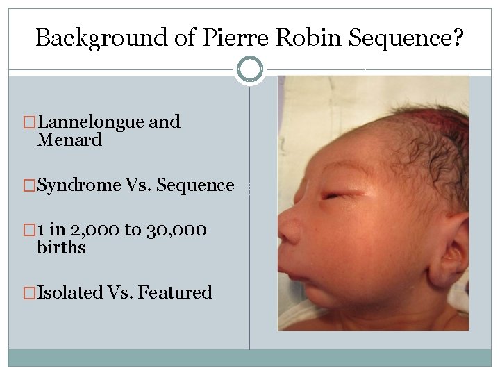 Background of Pierre Robin Sequence? �Lannelongue and Menard �Syndrome Vs. Sequence � 1 in Background of Pierre Robin Sequence? �Lannelongue and Menard �Syndrome Vs. Sequence � 1 in