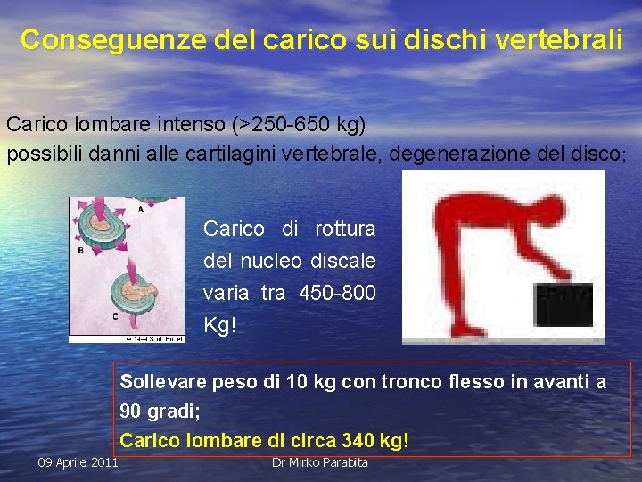 Conseguenze del carico sui dischi vertebrali Carico lombare intenso (>250 -650 kg) possibili danni