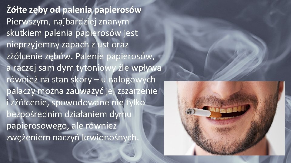 Żółte zęby od palenia papierosów Pierwszym, najbardziej znanym skutkiem palenia papierosów jest nieprzyjemny zapach