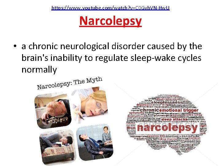 https: //www. youtube. com/watch? v=C 0 Gyh. VN-Hw. U Narcolepsy • a chronic neurological