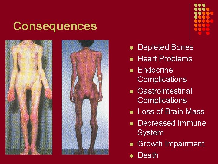 Consequences l l l l Depleted Bones Heart Problems Endocrine Complications Gastrointestinal Complications Loss