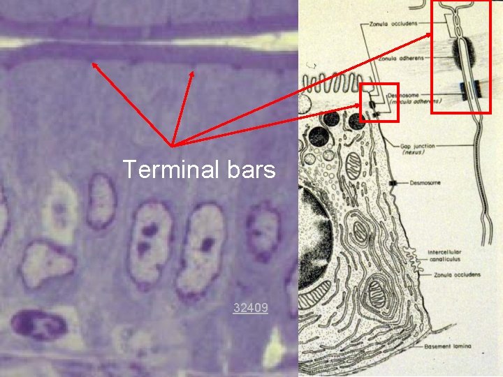 Terminal bars 32409 