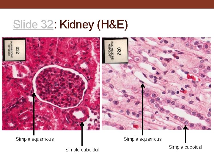 Slide 32: Kidney (H&E) Simple squamous Simple cuboidal 