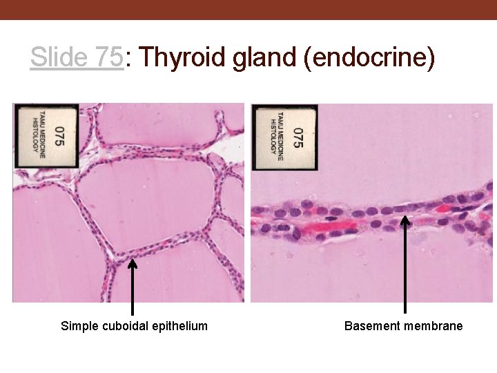 Slide 75: Thyroid gland (endocrine) Simple cuboidal epithelium Basement membrane 