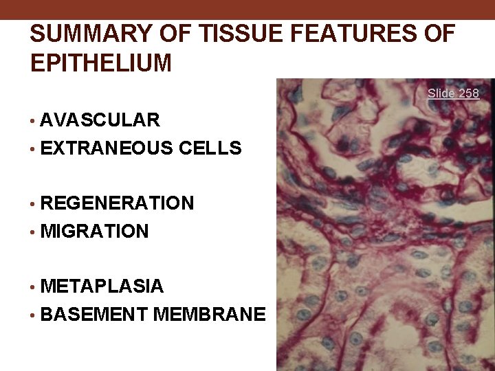 SUMMARY OF TISSUE FEATURES OF EPITHELIUM Slide 258 • AVASCULAR • EXTRANEOUS CELLS •