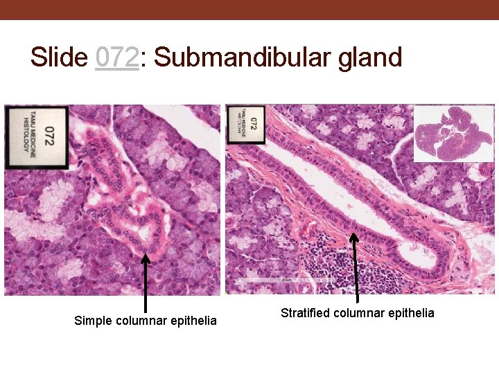 Slide 072: Submandibular gland Simple columnar epithelia Stratified columnar epithelia 
