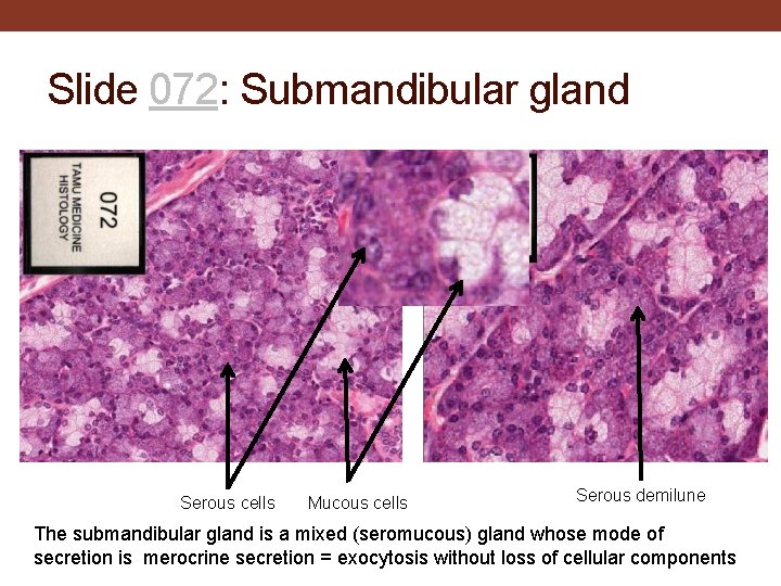 Slide 072: Submandibular gland Serous cells Mucous cells Serous demilune The submandibular gland is