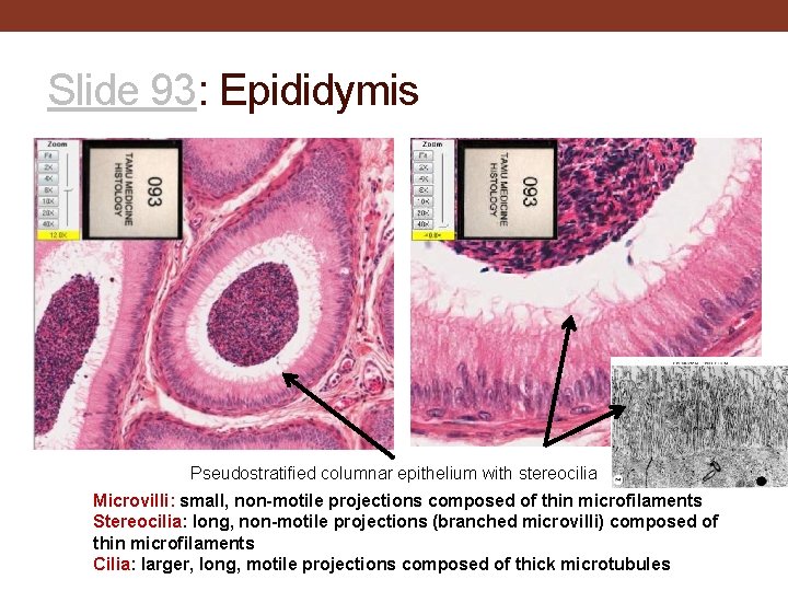 Slide 93: Epididymis Pseudostratified columnar epithelium with stereocilia Microvilli: small, non-motile projections composed of