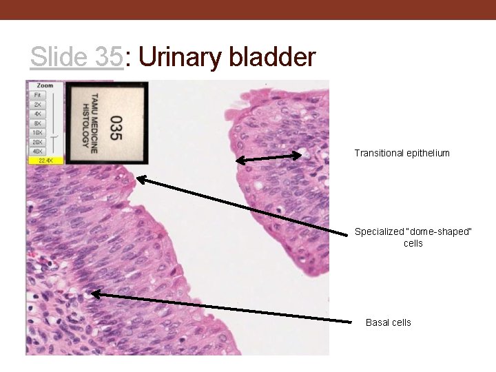 Slide 35: Urinary bladder Transitional epithelium Specialized “dome-shaped” cells Basal cells 