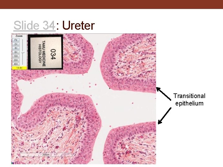 Slide 34: Ureter Transitional epithelium 