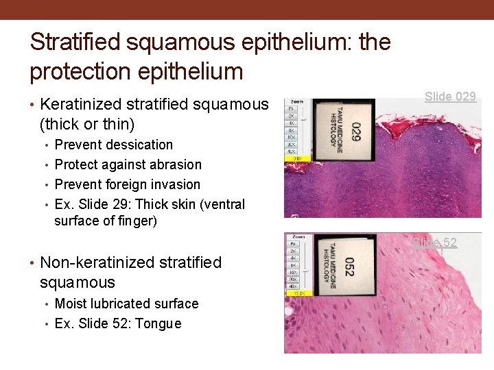 Stratified squamous epithelium: the protection epithelium • Keratinized stratified squamous Slide 029 (thick or