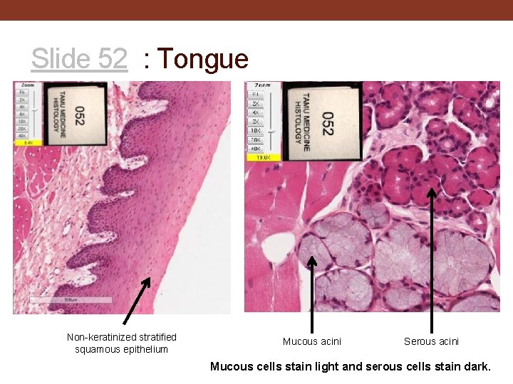 Slide 52 : Tongue Non-keratinized stratified squamous epithelium Mucous acini Serous acini Mucous cells