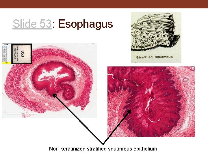 Slide 53: Esophagus Non-keratinized stratified squamous epithelium 