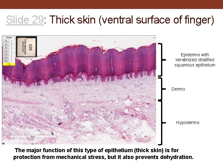 Slide 29: Thick skin (ventral surface of finger) Epidermis with keratinized stratified squamous epithelium