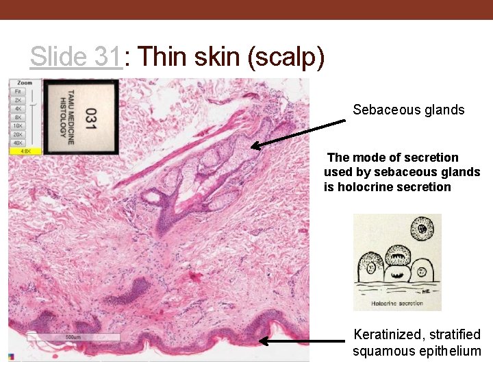 Slide 31: Thin skin (scalp) Sebaceous glands The mode of secretion used by sebaceous