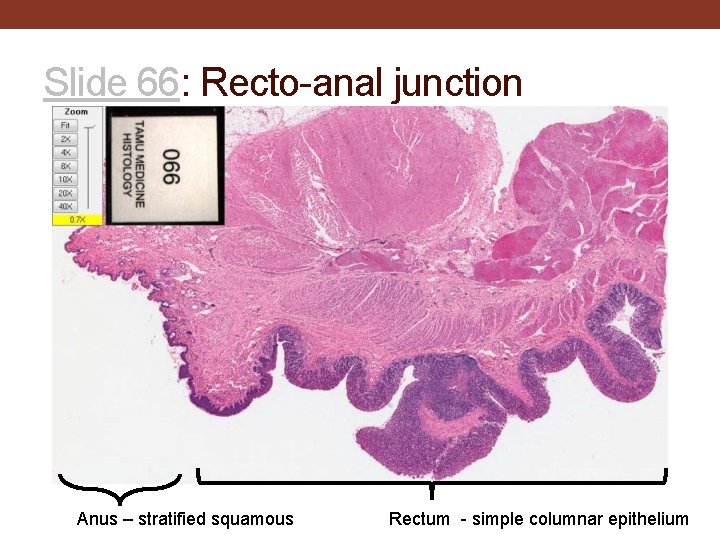 Slide 66: Recto-anal junction Anus – stratified squamous Rectum - simple columnar epithelium 