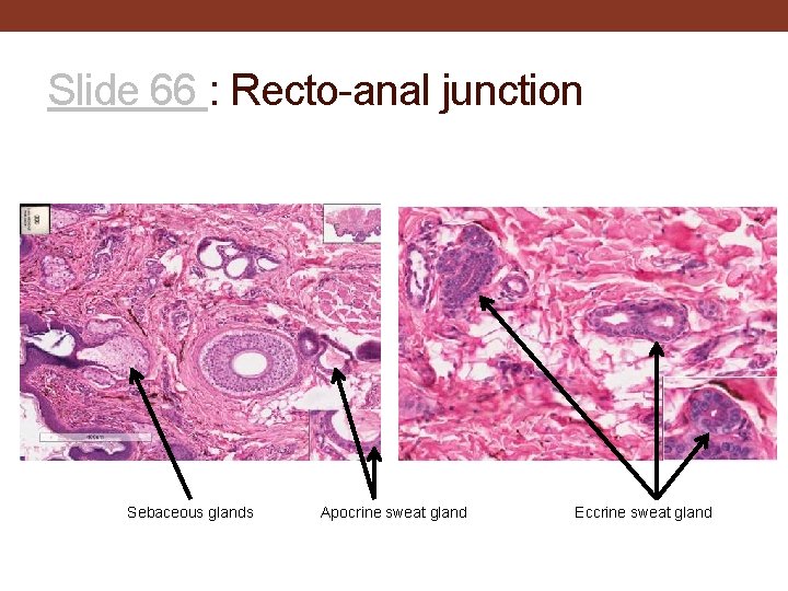 Slide 66 : Recto-anal junction Sebaceous glands Apocrine sweat gland Eccrine sweat gland 