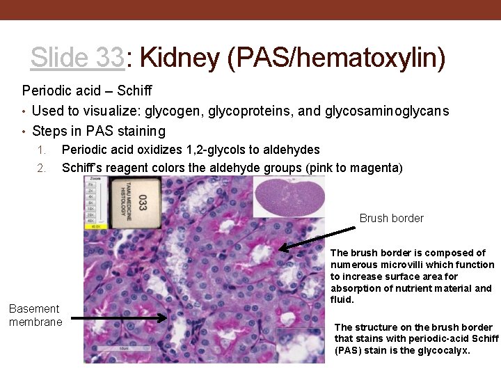 Slide 33: Kidney (PAS/hematoxylin) Periodic acid – Schiff • Used to visualize: glycogen, glycoproteins,