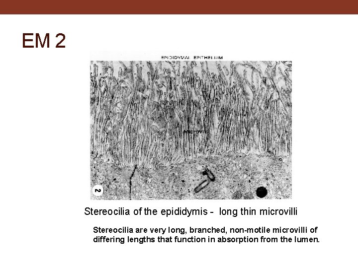 EM 2 Stereocilia of the epididymis - long thin microvilli Stereocilia are very long,