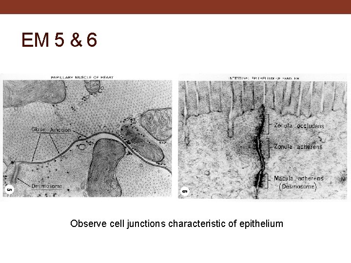 EM 5 & 6 Observe cell junctions characteristic of epithelium 