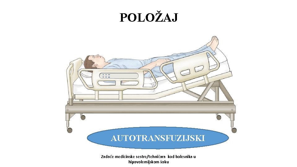 POLOŽAJ AUTOTRANSFUZIJSKI Zadaće medicinske sestre/tehničara kod bolesnika u hipovolemijskom šoku 