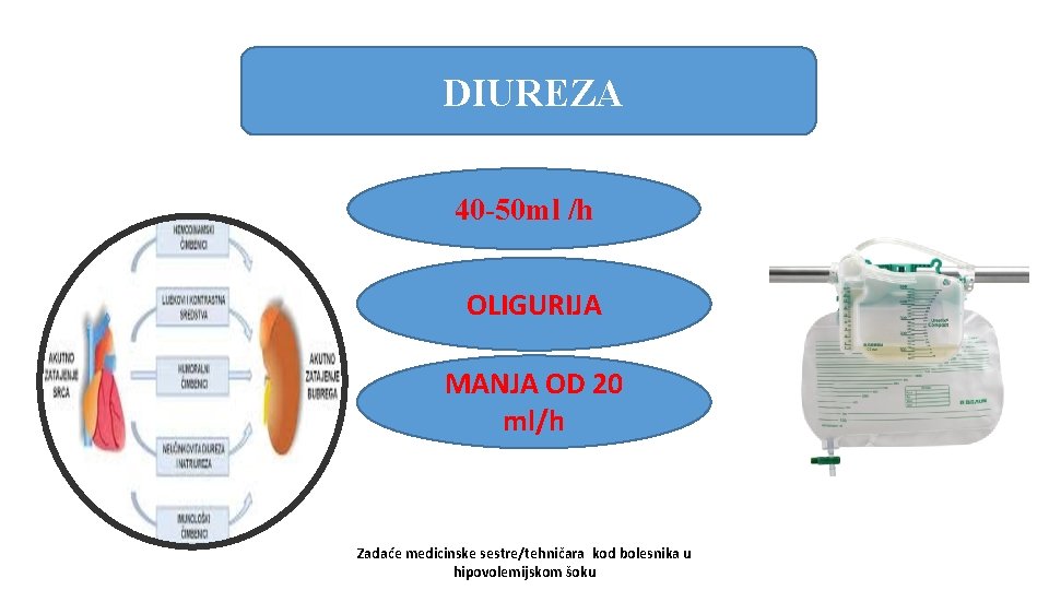 DIUREZA 40 -50 ml /h OLIGURIJA MANJA OD 20 ml/h Zadaće medicinske sestre/tehničara kod