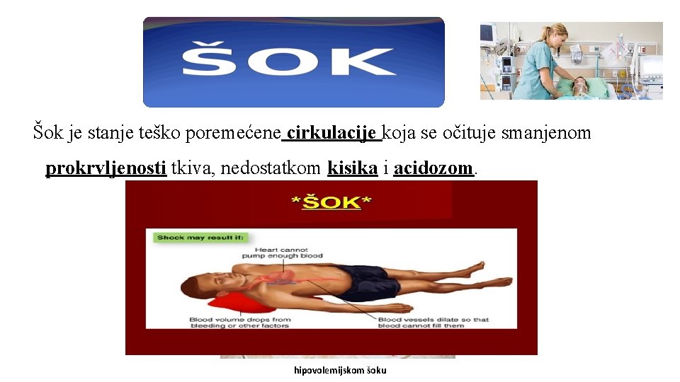 Šok je stanje teško poremećene cirkulacije koja se očituje smanjenom prokrvljenosti tkiva, nedostatkom kisika