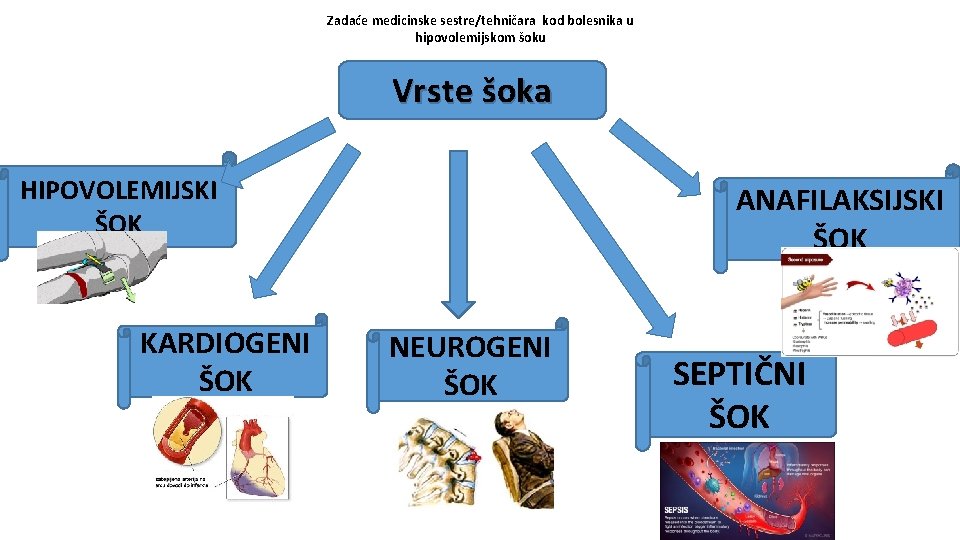 Zadaće medicinske sestre/tehničara kod bolesnika u hipovolemijskom šoku Vrste šoka HIPOVOLEMIJSKI ŠOK KARDIOGENI ŠOK