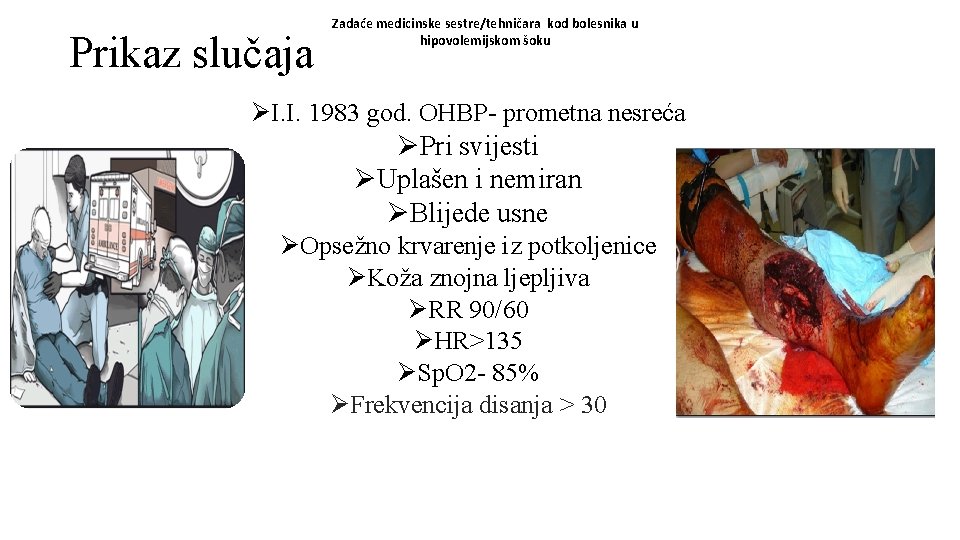 Prikaz slučaja Zadaće medicinske sestre/tehničara kod bolesnika u hipovolemijskom šoku ØI. I. 1983 god.