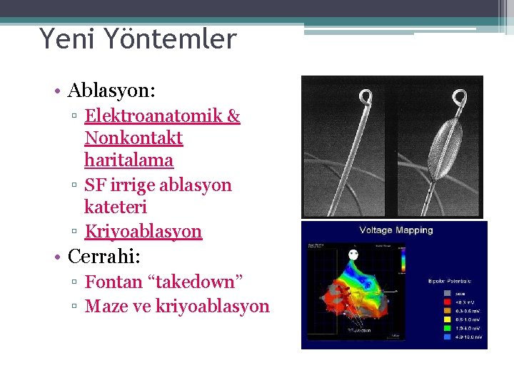 Yeni Yöntemler • Ablasyon: ▫ Elektroanatomik & Nonkontakt haritalama ▫ SF irrige ablasyon kateteri