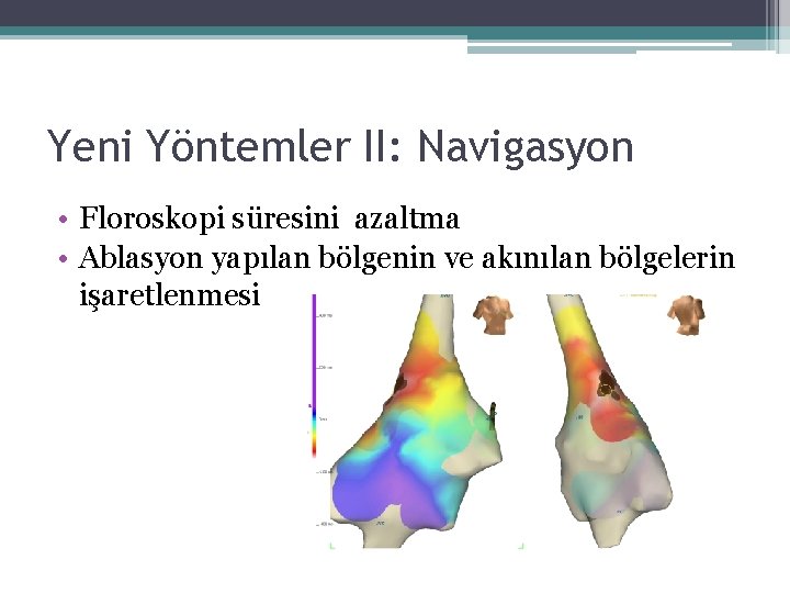 Yeni Yöntemler II: Navigasyon • Floroskopi süresini azaltma • Ablasyon yapılan bölgenin ve akınılan