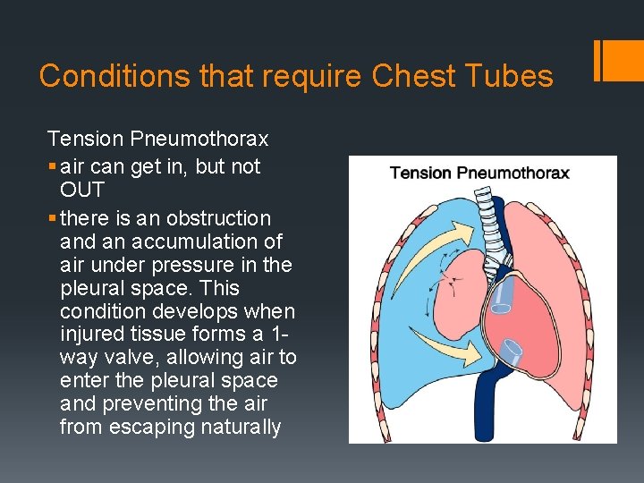 Conditions that require Chest Tubes Tension Pneumothorax § air can get in, but not