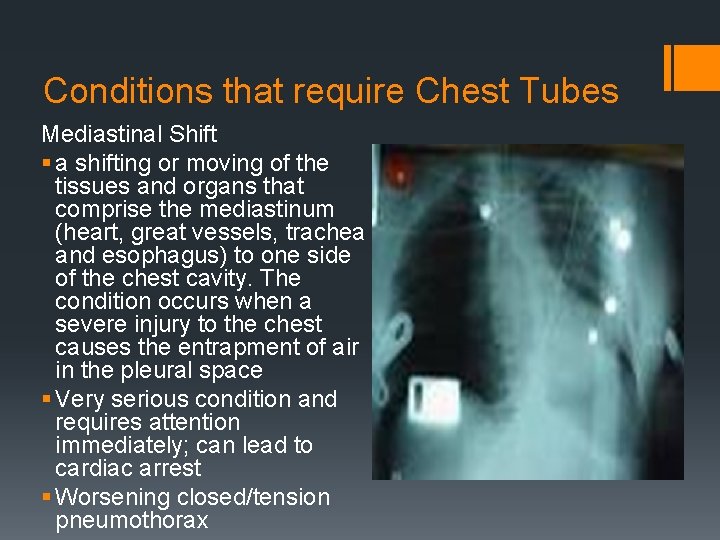 Conditions that require Chest Tubes Mediastinal Shift § a shifting or moving of the