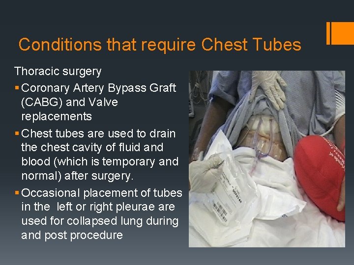 Conditions that require Chest Tubes Thoracic surgery § Coronary Artery Bypass Graft (CABG) and