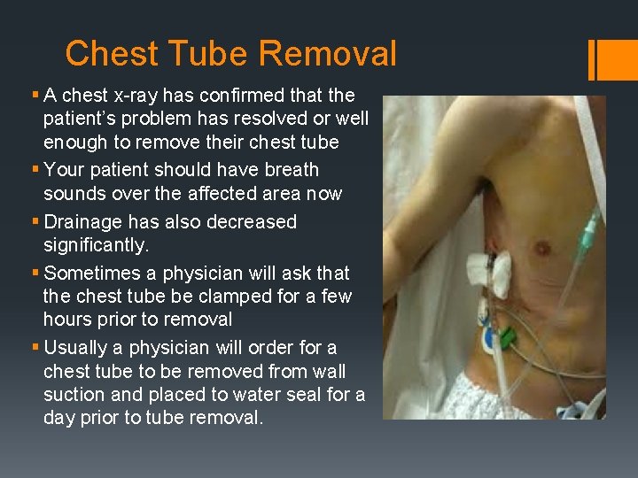 Chest Tube Removal § A chest x-ray has confirmed that the patient’s problem has