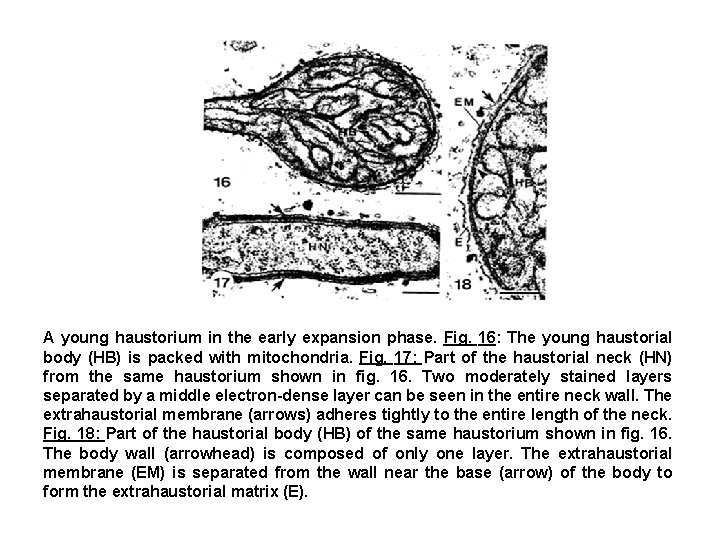 A young haustorium in the early expansion phase. Fig. 16: The young haustorial body