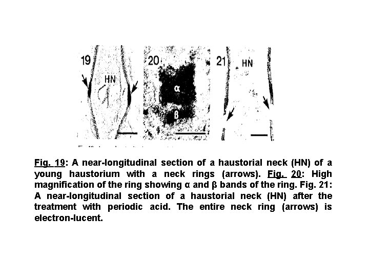 Fig. 19: A near-longitudinal section of a haustorial neck (HN) of a young haustorium