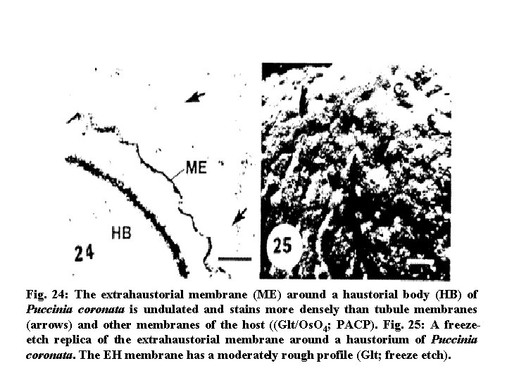 Fig. 24: The extrahaustorial membrane (ME) around a haustorial body (HB) of Puccinia coronata
