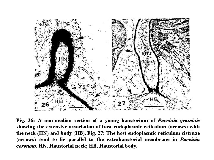 Fig. 26: A non-median section of a young haustorium of Puccinia graminis showing the