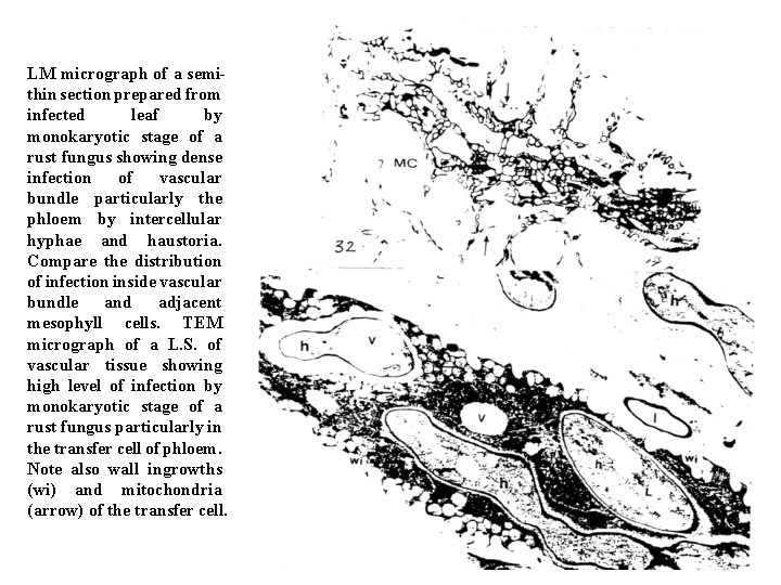 LM micrograph of a semithin section prepared from infected leaf by monokaryotic stage of