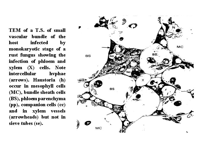 TEM of a T. S. of small vascular bundle of the host infected by