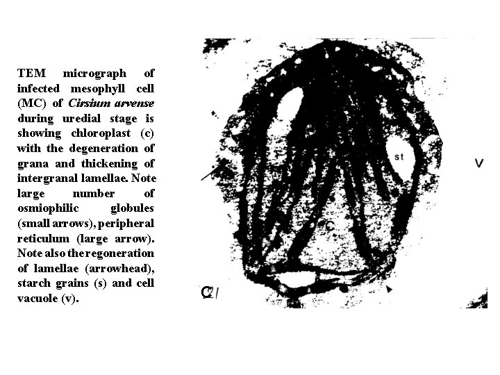 TEM micrograph of infected mesophyll cell (MC) of Cirsium arvense during uredial stage is
