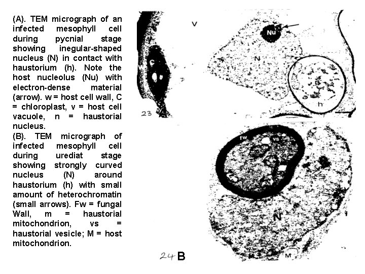 (A). TEM micrograph of an infected mesophyll cell during pycnial stage showing inegular-shaped nucleus