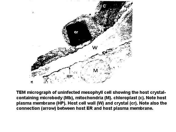TEM micrograph of uninfected mesophyll cell showing the host crystalcontaining microbody (Mb), mitochondria (M).