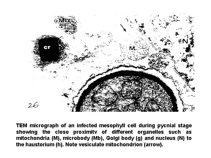 TEM micrograph of an infected mesophyll cell during pycnial stage showing the close proximitv