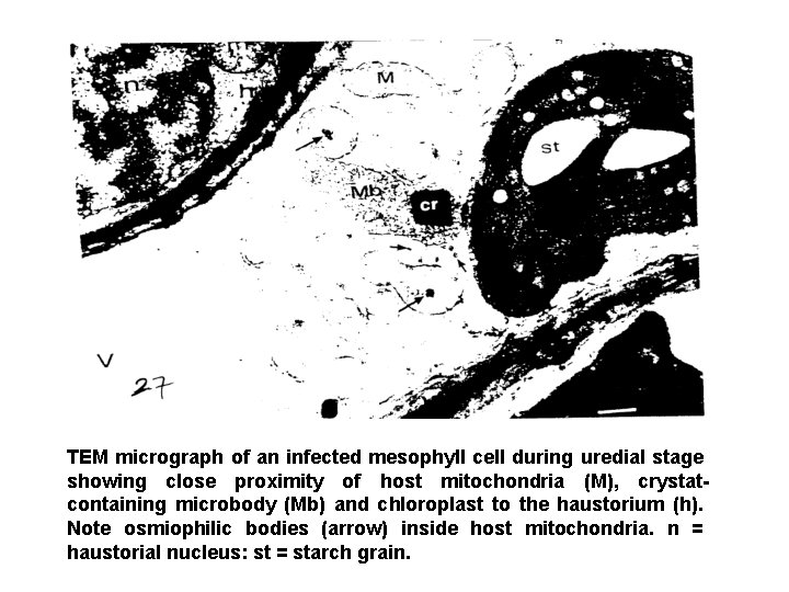 TEM micrograph of an infected mesophyll cell during uredial stage showing close proximity of