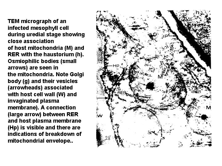 TEM micrograph of an infected mesophyll cell during uredial stage showing close association of