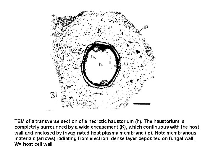 TEM of a transverse section of a necrotic haustorium (h). The haustorium is completely