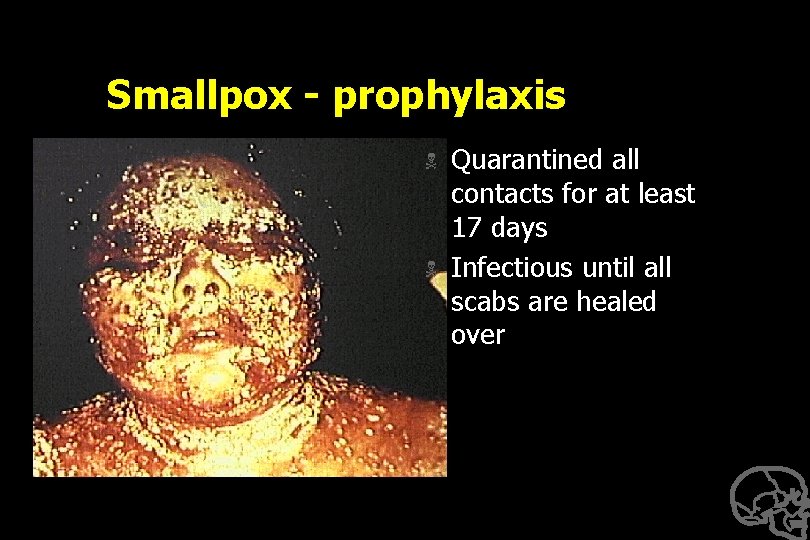 Smallpox - prophylaxis N N Quarantined all contacts for at least 17 days Infectious