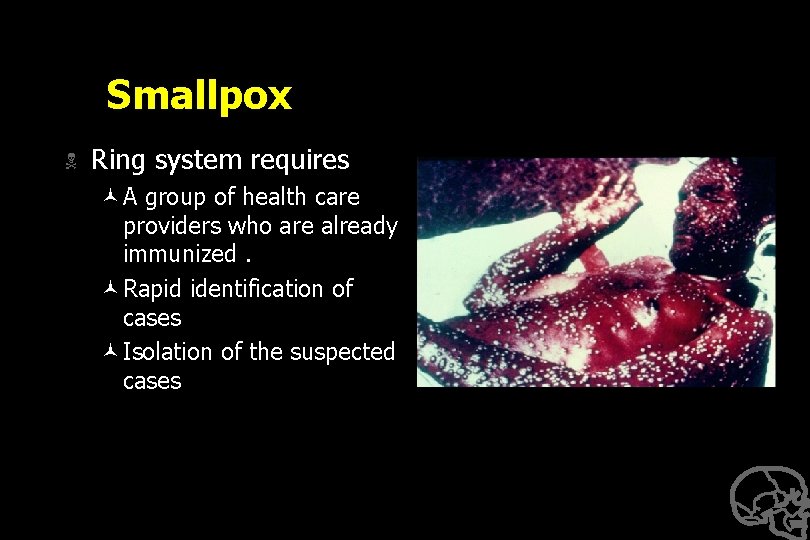 Smallpox N Ring system requires ©A group of health care providers who are already